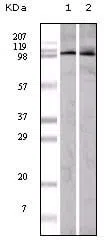 EphA1 Mouse Monoclonal Antibody - Size: 50µl