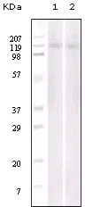 EphB6 Mouse Monoclonal Antibody - Size: 100µl