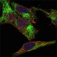 INHA (Inhibin alpha) Mouse Monoclonal Antibody - Size: 100µl