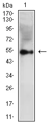 Vimentin Mouse Monoclonal Antibody