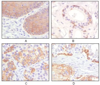 Cytokeratin 5 Mouse Monoclonal Antibody - Size: 100µl