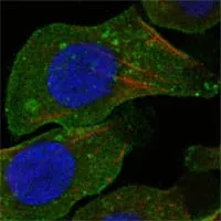 DDR2 Mouse Monoclonal Antibody - Size: 100µl