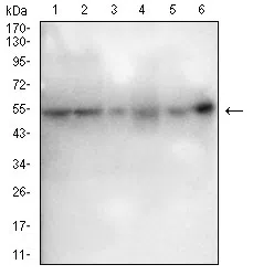 ESR1 Mouse Monoclonal Antibody - Size: 100µl