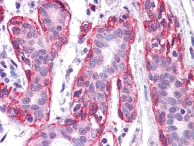 FRK Mouse Monoclonal Antibody - Size: 50µl