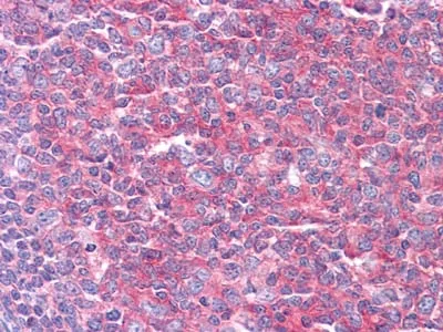 KARS Mouse Monoclonal Antibody - Size: 50µl