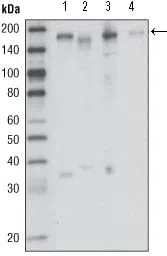 RON Mouse Monoclonal Antibody - Size: 100µl