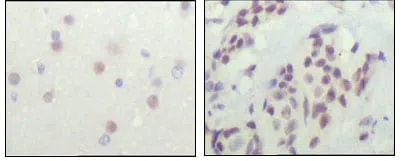 NCOR1 Mouse Monoclonal Antibody - Size: 100µl