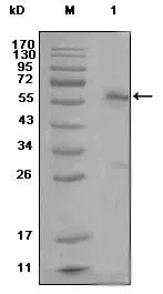 ESR1 Mouse Monoclonal Antibody - Size: 100µl