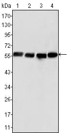 Vimentin Mouse Monoclonal Antibody - Size: 50µl