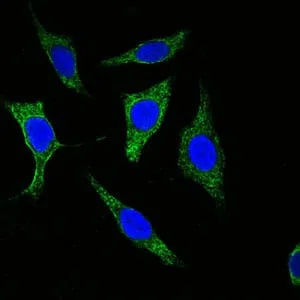 Cytokeratin(Pan) Mouse Monoclonal Antibody - Size: 100µl