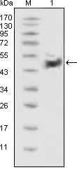 p53 Mouse Monoclonal Antibody - Size: 50µl