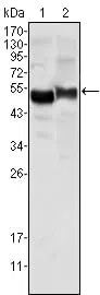 AAT Mouse Monoclonal Antibody - Size: 100µl