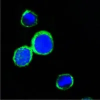 REG1A Mouse Monoclonal Antibody - Size: 100µl