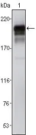 PDGFR Mouse Monoclonal Antibody - Size: 100µl