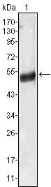 AGT Mouse Monoclonal Antibody - Size: 50µl