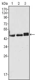 CK17 Mouse Monoclonal Antibody - Size: 100µl