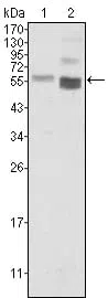 PTEN Mouse Monoclonal Antibody - Size: 100µl