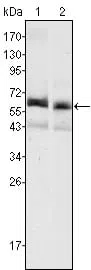 AFP Mouse Monoclonal Antibody - Size: 50µl