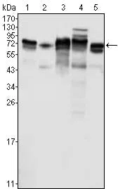 Metadherin Mouse Monoclonal Antibody - Size: 100µl