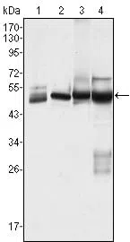 CK7 Mouse Monoclonal Antibody - Size: 100µl