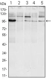 ERN1 Mouse Monoclonal Antibody - Size: 100µl