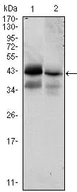EPCAM Mouse Monoclonal Antibody - Size: 100µl