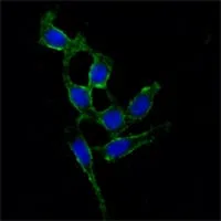 FAK Mouse Monoclonal Antibody - Size: 100µl
