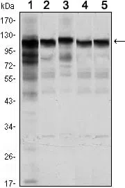 HK1 Mouse Monoclonal Antibody - Size: 50µl