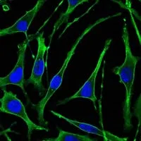 PTH1R Mouse Monoclonal Antibody - Size: 100µl