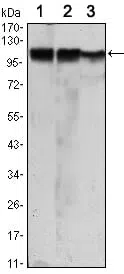 HK2 Mouse Monoclonal Antibody - Size: 100µl