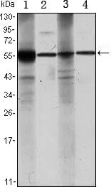ALDH1A1 Mouse Monoclonal Antibody - Size: 100µl