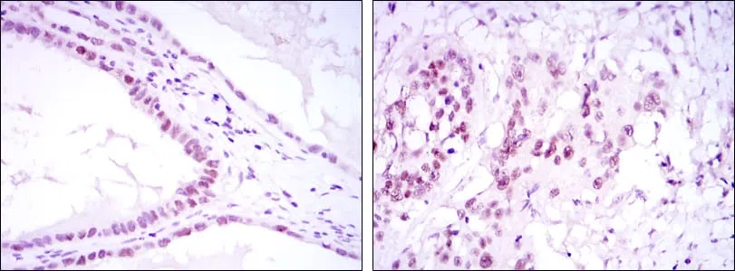 SUZ12 Mouse Monoclonal Antibody - Size: 100µl