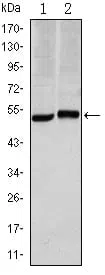 CA9 Mouse Monoclonal Antibody - Size: 100µl
