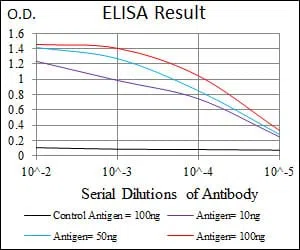 ALPL Mouse Monoclonal Antibody - Size: 100µl
