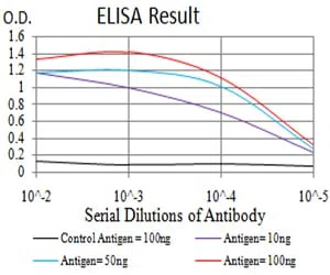 TTF1 Mouse Monoclonal Antibody - Size: 100µl