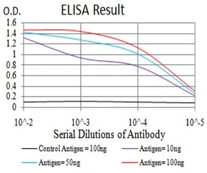 ALK Mouse Monoclonal Antibody - Size: 50µl