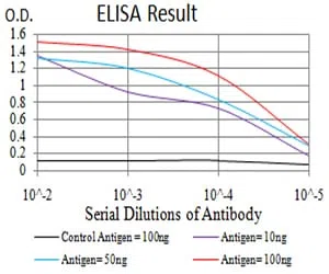 MITF Mouse Monoclonal Antibody - Size: 50µl
