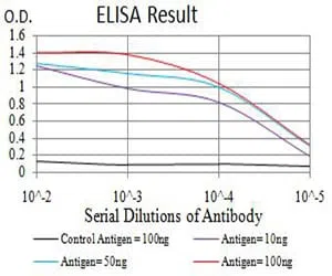 PAK3 Mouse Monoclonal Antibody - Size: 50µl