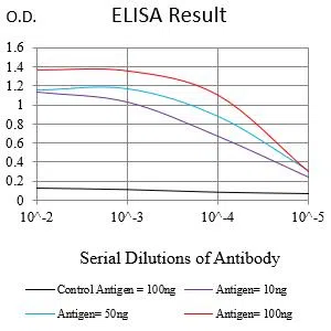 MKI67 Mouse Monoclonal Antibody - Size: 100µl