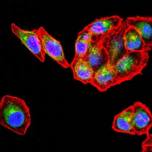 CD206 Mouse Monoclonal Antibody - Size: 100µl