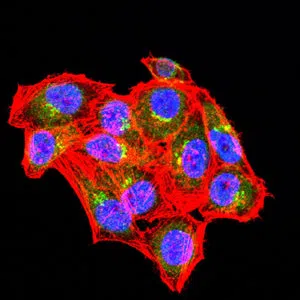 ABCA1 Mouse Monoclonal Antibody - Size: 100µl