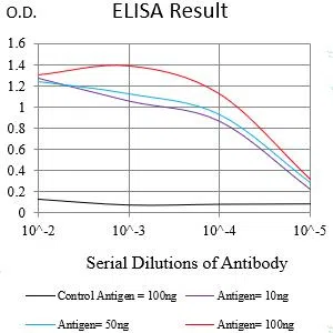 ALK/p80 Mouse Monoclonal Antibody - Size: 100µl