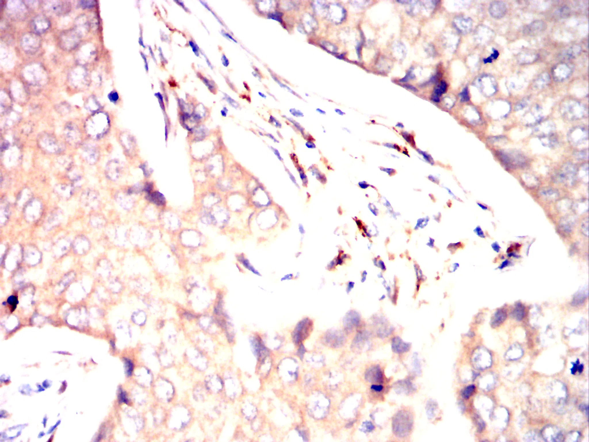 CD116 Mouse Monoclonal Antibody - Size: 50µl