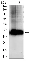 AKR1C1 Mouse Monoclonal Antibody - Size: 100µl