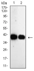 AKR1C1 Mouse Monoclonal Antibody - Size: 50µl