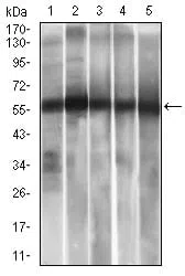 ALDH2 Mouse Monoclonal Antibody - Size: 100µl