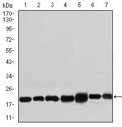 RPL18A Mouse Monoclonal Antibody - Size: 100µl