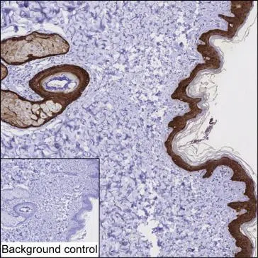 KRT3 Mouse Monoclonal Antibody - Size: 100µl