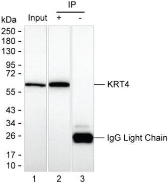 KRT4 Mouse Monoclonal Antibody - Size: 50µl
