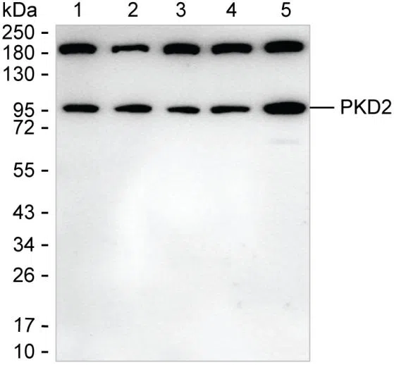 PKD2 Mouse Monoclonal Antibody - Size: 50µl